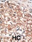 BMPR1B Antibody (C-term)